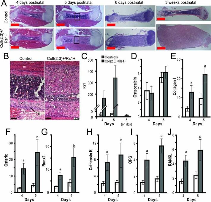 https://cdn.ncbi.nlm.nih.gov/pmc/blobs/ca32/3153396/6aa750b6d1b9/jbmr0025-0584-f3.jpg
