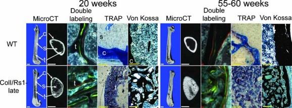 https://cdn.ncbi.nlm.nih.gov/pmc/blobs/ca32/3153396/a877107c370e/jbmr0025-0584-f6.jpg