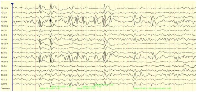 https://cdn.ncbi.nlm.nih.gov/pmc/blobs/ca36/4500918/a12a9c1ff36d/fnhum-09-00194-g001.jpg