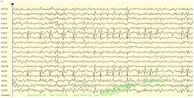 https://cdn.ncbi.nlm.nih.gov/pmc/blobs/ca36/4500918/f474158c12bc/fnhum-09-00194-g002.jpg