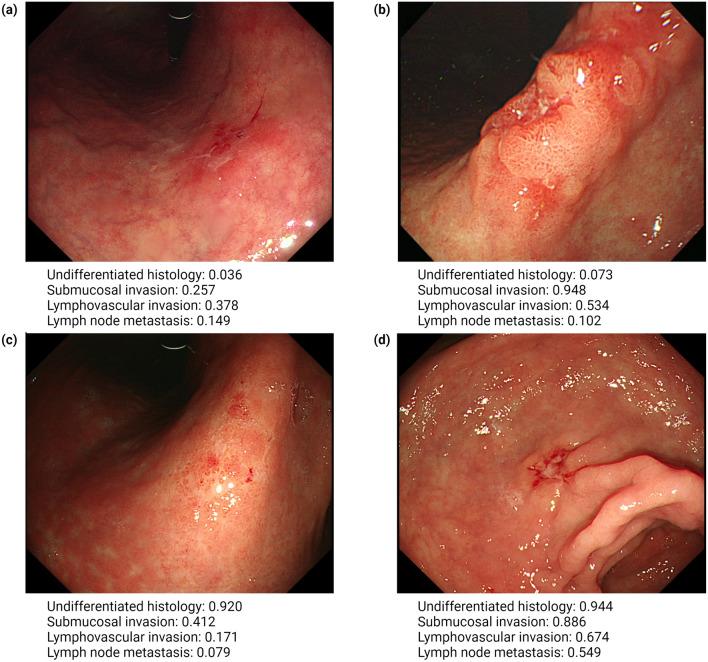 https://cdn.ncbi.nlm.nih.gov/pmc/blobs/ca39/11335909/3e0efecdfb19/10120_2024_1524_Fig2_HTML.jpg