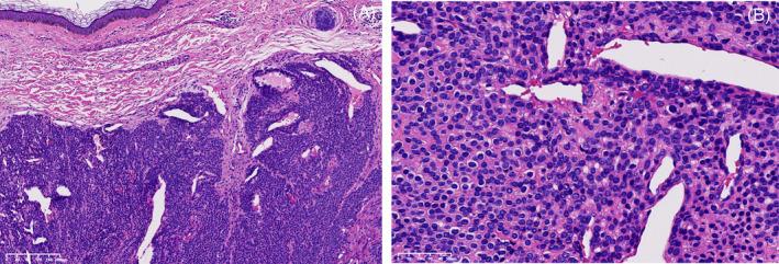 https://cdn.ncbi.nlm.nih.gov/pmc/blobs/ca41/11705498/3995c793d909/CNR2-8-e70113-g003.jpg