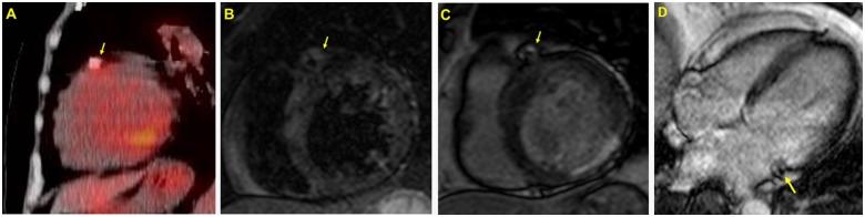 https://cdn.ncbi.nlm.nih.gov/pmc/blobs/ca46/7047045/78c33583bc83/ytaa001f3.jpg