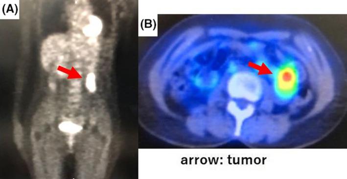 https://cdn.ncbi.nlm.nih.gov/pmc/blobs/ca4a/7752332/74628afb88f0/CCR3-8-3344-g002.jpg