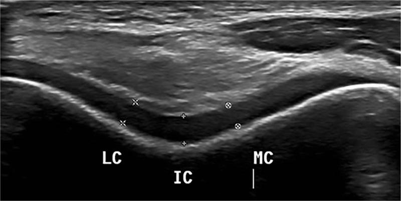 https://cdn.ncbi.nlm.nih.gov/pmc/blobs/ca4d/7220742/824ea6dfe8d7/medi-99-e19455-g001.jpg