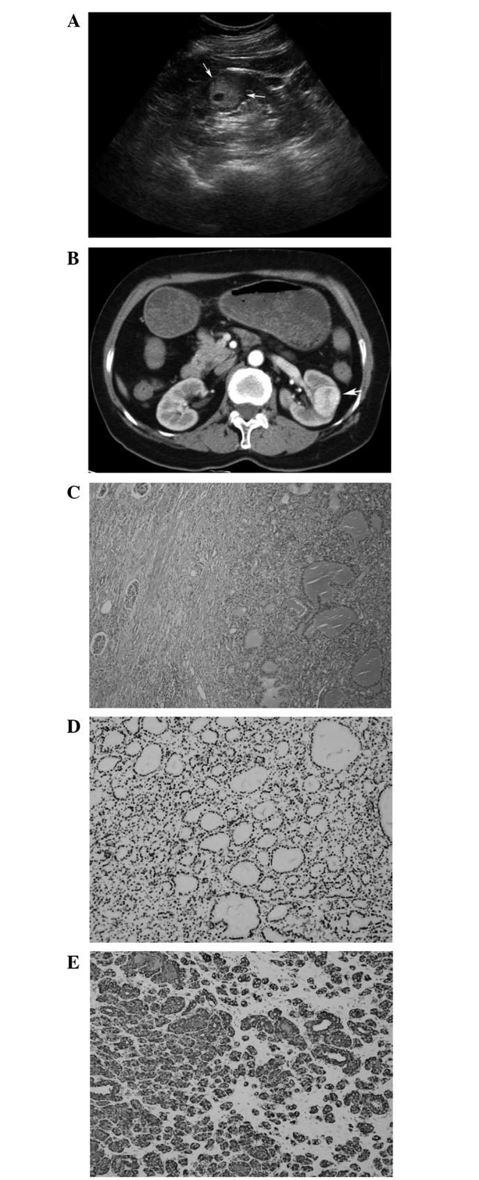 https://cdn.ncbi.nlm.nih.gov/pmc/blobs/ca4f/4840877/4fc9f9d86cf6/ol-11-05-3293-g00.jpg