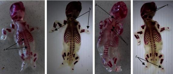 https://cdn.ncbi.nlm.nih.gov/pmc/blobs/ca52/11567719/16c55378422d/JT2024-9986648.005.jpg