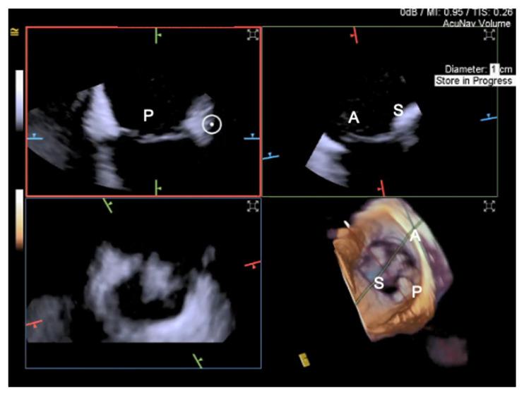 https://cdn.ncbi.nlm.nih.gov/pmc/blobs/ca54/10219492/23a98c392b30/jcm-12-03384-g015.jpg