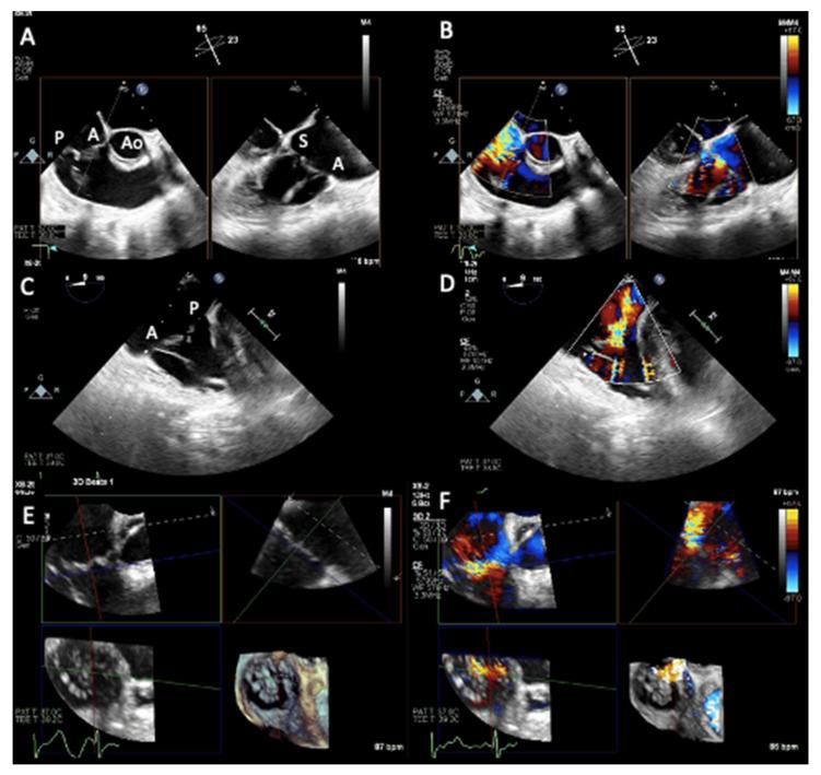 https://cdn.ncbi.nlm.nih.gov/pmc/blobs/ca54/10219492/3bdfe0f0e1b2/jcm-12-03384-g007.jpg