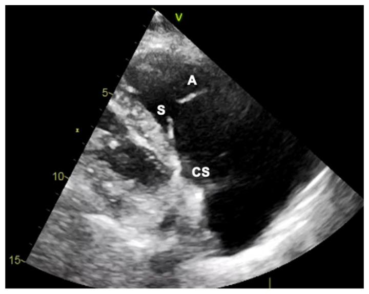 https://cdn.ncbi.nlm.nih.gov/pmc/blobs/ca54/10219492/448e07ddcff0/jcm-12-03384-g003.jpg