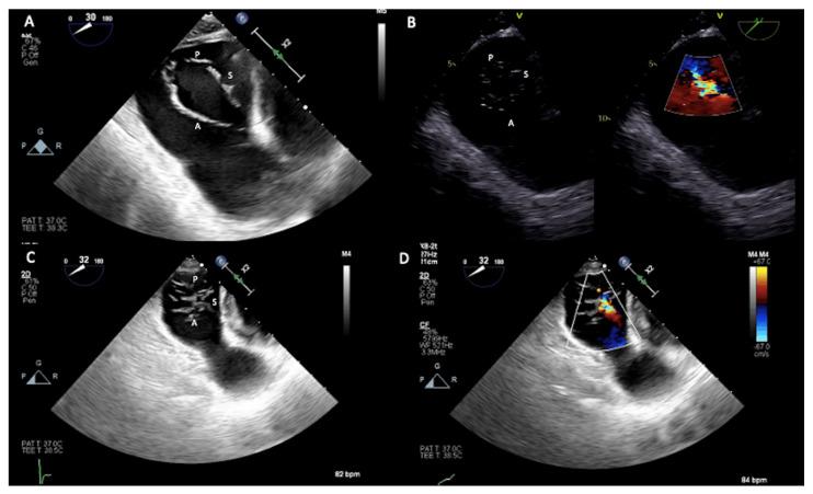 https://cdn.ncbi.nlm.nih.gov/pmc/blobs/ca54/10219492/6e7c28ea3c5a/jcm-12-03384-g008.jpg