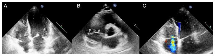 https://cdn.ncbi.nlm.nih.gov/pmc/blobs/ca54/10219492/a7299b7c52f6/jcm-12-03384-g004.jpg