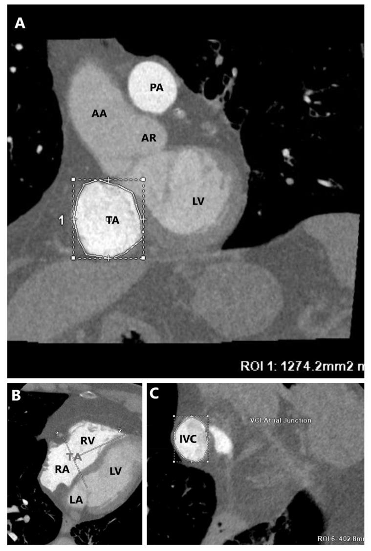 https://cdn.ncbi.nlm.nih.gov/pmc/blobs/ca54/10219492/afca3ee27245/jcm-12-03384-g010.jpg
