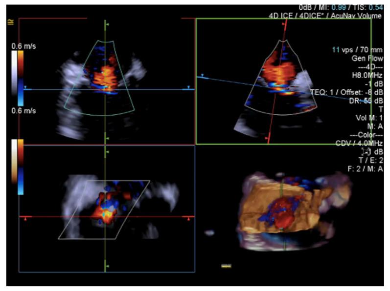 https://cdn.ncbi.nlm.nih.gov/pmc/blobs/ca54/10219492/dcdc4b94b334/jcm-12-03384-g017.jpg