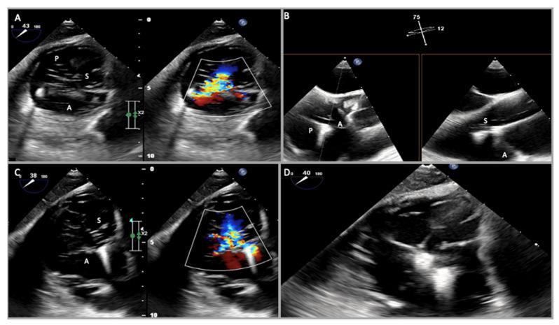 https://cdn.ncbi.nlm.nih.gov/pmc/blobs/ca54/10219492/ef2449000190/jcm-12-03384-g012.jpg