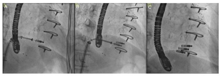 https://cdn.ncbi.nlm.nih.gov/pmc/blobs/ca54/10219492/f8470f47444b/jcm-12-03384-g018.jpg