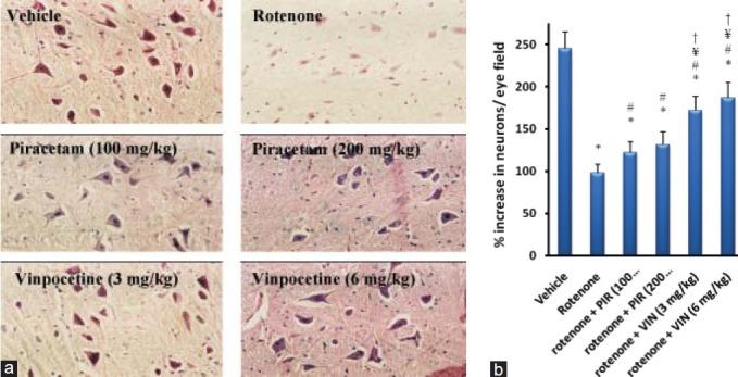 https://cdn.ncbi.nlm.nih.gov/pmc/blobs/ca5f/3523508/ab3ed5f683c5/IJPharm-44-774-g005.jpg