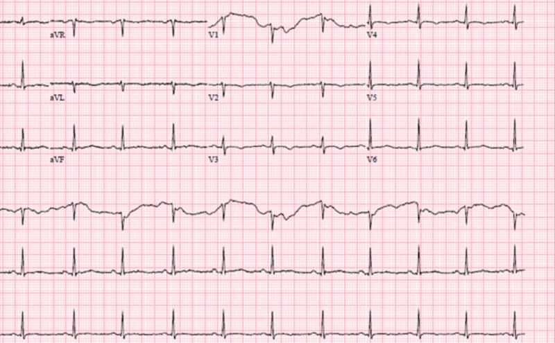 https://cdn.ncbi.nlm.nih.gov/pmc/blobs/ca5f/7682945/9290be3687d7/cureus-0012-00000011132-i01.jpg