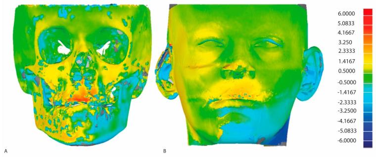 https://cdn.ncbi.nlm.nih.gov/pmc/blobs/ca61/11122183/ffc1a0b5b4f6/jcm-13-02890-g001.jpg
