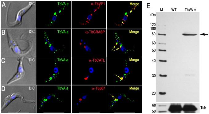https://cdn.ncbi.nlm.nih.gov/pmc/blobs/ca62/4263762/62a3d661ec4c/ppat.1004555.g004.jpg