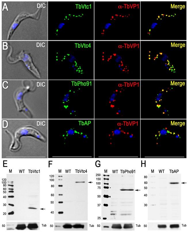 https://cdn.ncbi.nlm.nih.gov/pmc/blobs/ca62/4263762/b850cef856bc/ppat.1004555.g003.jpg