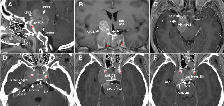 https://cdn.ncbi.nlm.nih.gov/pmc/blobs/ca66/10232909/67513cd63431/fonc-13-1169224-g004.jpg