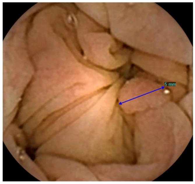 https://cdn.ncbi.nlm.nih.gov/pmc/blobs/ca72/9407289/af6aa34d085b/diagnostics-12-01994-g003.jpg