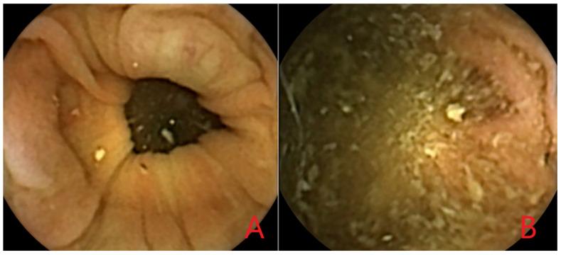 https://cdn.ncbi.nlm.nih.gov/pmc/blobs/ca72/9407289/d7f9652aa8f9/diagnostics-12-01994-g002.jpg