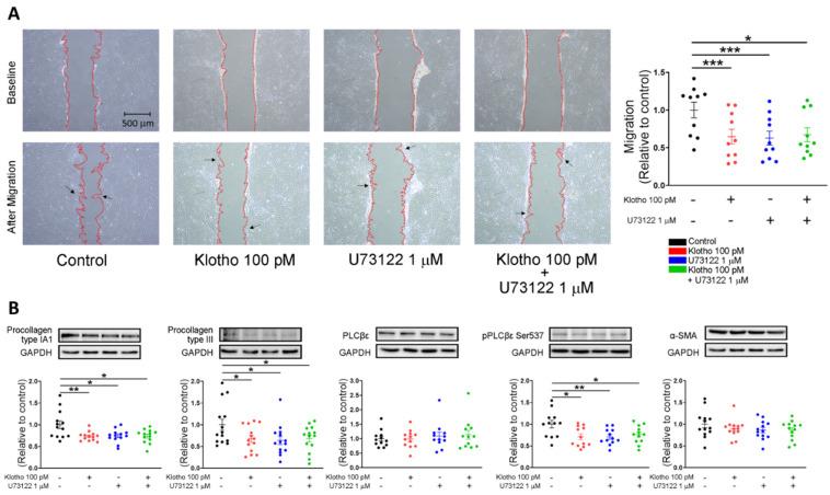 https://cdn.ncbi.nlm.nih.gov/pmc/blobs/ca74/9312905/8655d5b82efa/biomedicines-10-01574-g004.jpg