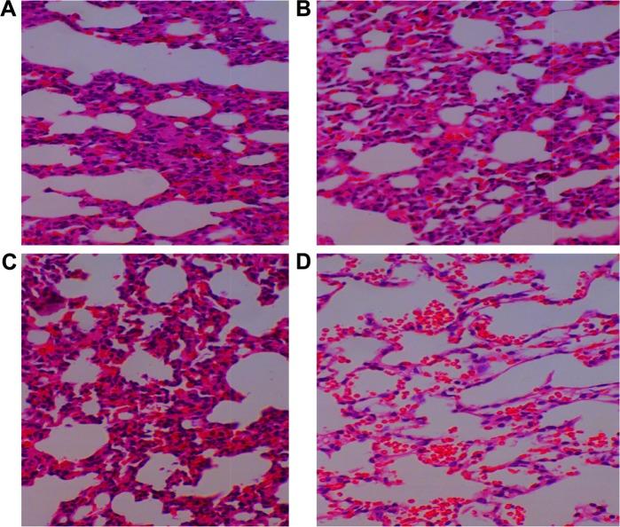 https://cdn.ncbi.nlm.nih.gov/pmc/blobs/ca7c/5207434/70d1dcb7323f/ijn-12-251Fig5.jpg