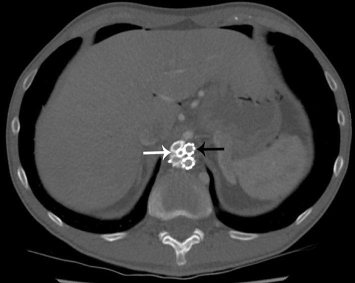 https://cdn.ncbi.nlm.nih.gov/pmc/blobs/ca7d/6180861/9f1e3950c53a/bjrcr.20150318.g001.jpg