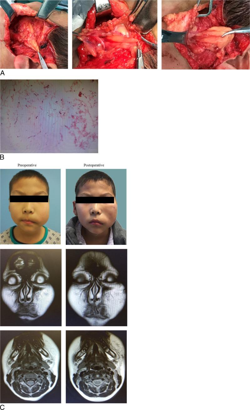 https://cdn.ncbi.nlm.nih.gov/pmc/blobs/ca83/5737463/b6992eef1328/spa-80-83-g003.jpg