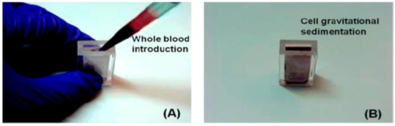 https://cdn.ncbi.nlm.nih.gov/pmc/blobs/ca83/5872065/7a9ce64e0504/biosensors-08-00017-g012a.jpg