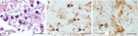 https://cdn.ncbi.nlm.nih.gov/pmc/blobs/ca89/2940682/a413e3e7d451/noq02604.jpg