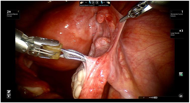 https://cdn.ncbi.nlm.nih.gov/pmc/blobs/ca89/9369034/666534c4eb05/jcm-11-04385-g004.jpg