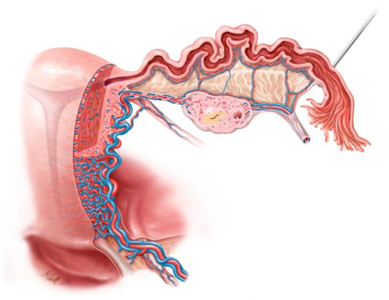 https://cdn.ncbi.nlm.nih.gov/pmc/blobs/ca89/9369034/bc957d733fe9/jcm-11-04385-g001.jpg