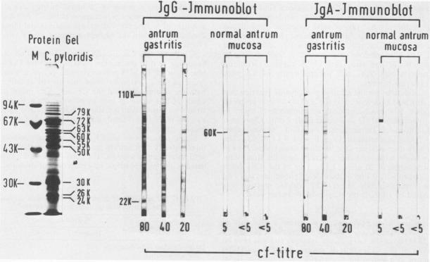 https://cdn.ncbi.nlm.nih.gov/pmc/blobs/ca91/269015/12f0290f6565/jcm00101-0054-a.jpg