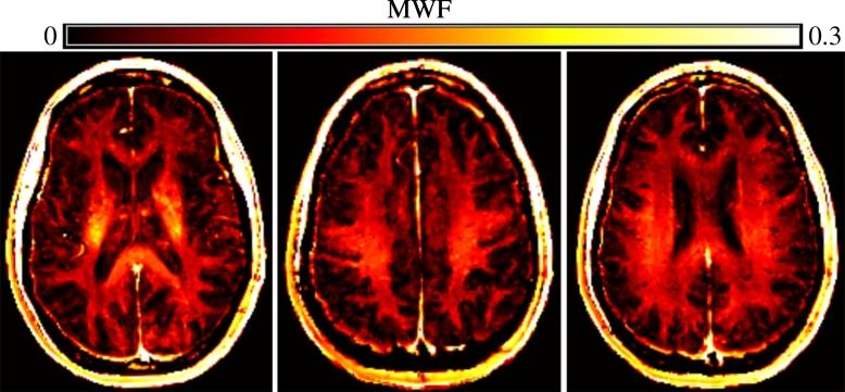 https://cdn.ncbi.nlm.nih.gov/pmc/blobs/ca92/5651626/f8faf1f94209/gr1.jpg