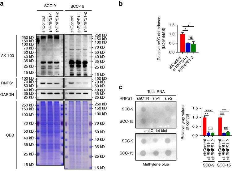 https://cdn.ncbi.nlm.nih.gov/pmc/blobs/ca93/10800354/482b41e83437/41368_2023_276_Fig4_HTML.jpg