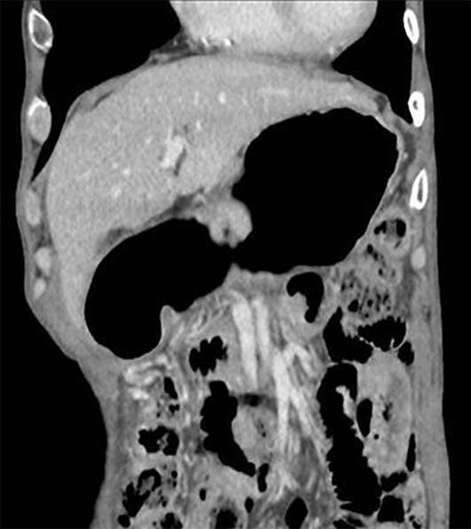 https://cdn.ncbi.nlm.nih.gov/pmc/blobs/ca93/5156887/1cf978500685/cro-0009-0752-g03.jpg