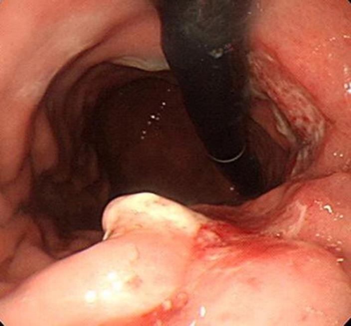 https://cdn.ncbi.nlm.nih.gov/pmc/blobs/ca93/5156887/4120091a3061/cro-0009-0752-g01.jpg