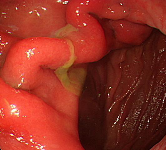 https://cdn.ncbi.nlm.nih.gov/pmc/blobs/ca93/5156887/e819ee4dafbf/cro-0009-0752-g05.jpg