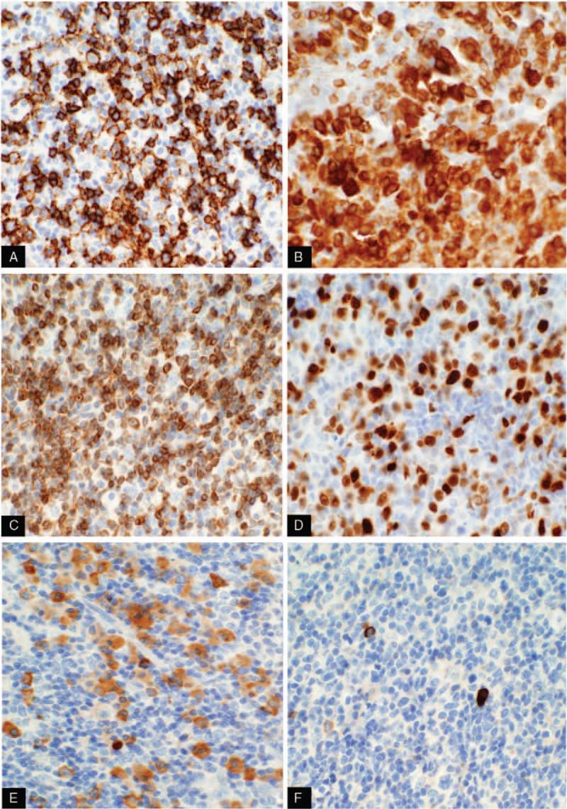 https://cdn.ncbi.nlm.nih.gov/pmc/blobs/ca94/5943870/1540f56903ea/medi-97-e9648-g002.jpg