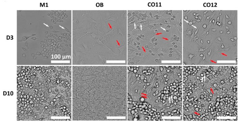 https://cdn.ncbi.nlm.nih.gov/pmc/blobs/ca95/12194544/051ef6151550/jfb-16-00217-g007.jpg
