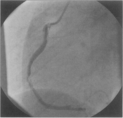 https://cdn.ncbi.nlm.nih.gov/pmc/blobs/ca96/2497317/5df868239ea1/Nheartj00091-0039-b.jpg