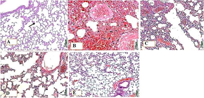 https://cdn.ncbi.nlm.nih.gov/pmc/blobs/ca9f/10924623/f5ab2f8e83c1/PAMJ-46-112-g006.jpg