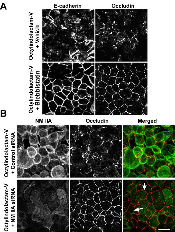 https://cdn.ncbi.nlm.nih.gov/pmc/blobs/caa2/2685374/a3b050b76646/1471-2121-10-36-6.jpg