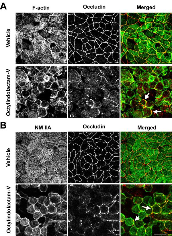 https://cdn.ncbi.nlm.nih.gov/pmc/blobs/caa2/2685374/c10180b260f8/1471-2121-10-36-4.jpg