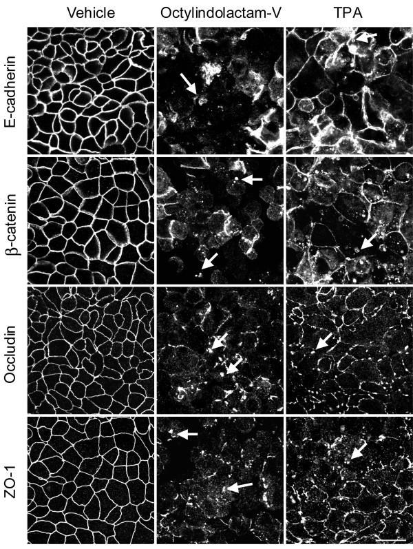 https://cdn.ncbi.nlm.nih.gov/pmc/blobs/caa2/2685374/d3f968b78707/1471-2121-10-36-2.jpg