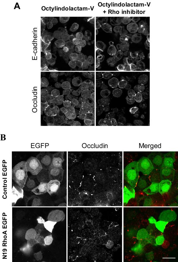 https://cdn.ncbi.nlm.nih.gov/pmc/blobs/caa2/2685374/f464da3b8461/1471-2121-10-36-10.jpg